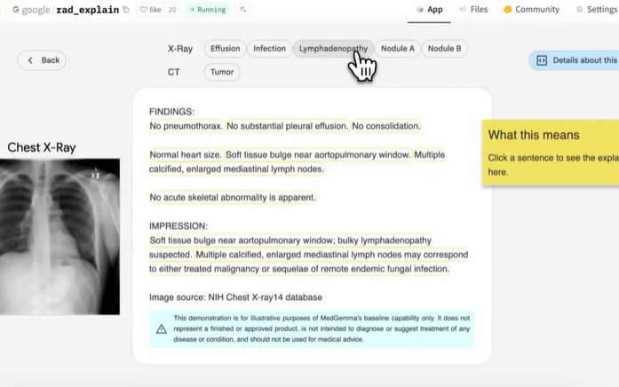 谷歌推出三款Gemma变体模型 覆盖医疗手语翻译海豚语言领域