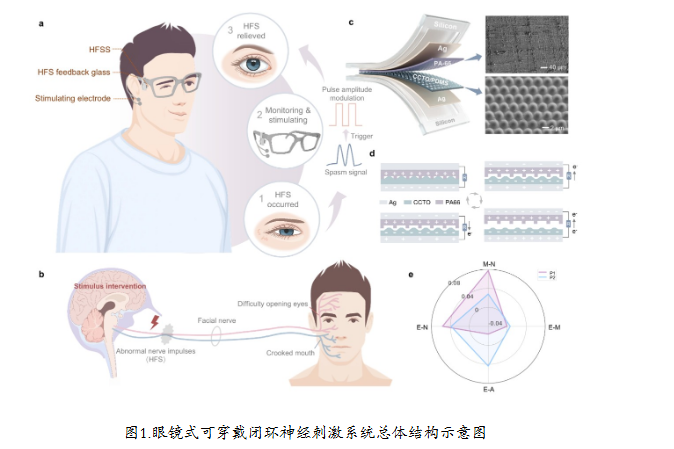 清华研发眼镜式闭环神经刺激系统 有效治疗面肌痉挛新成果登Nature子刊